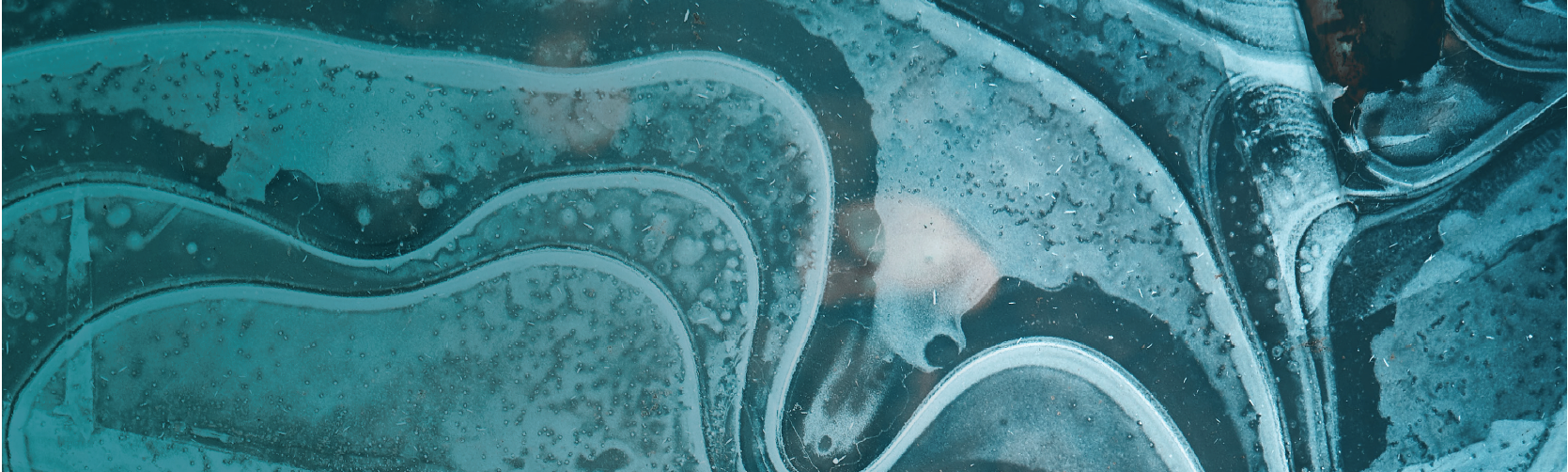 Get Ahead of the Cost Curve: Work Comp Offers Savings in a Hard Market